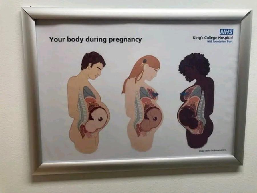 Your body during pregnancy NHSI King's College Hospital NHS Foundation Trust