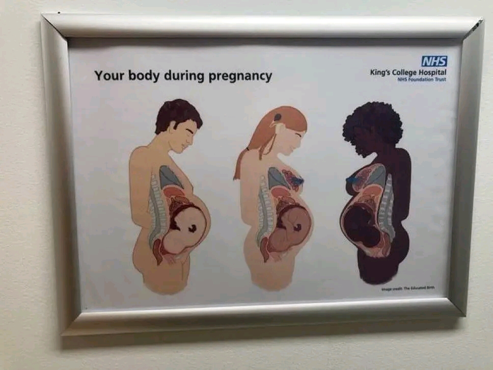 Your body during pregnancy NHSI King's College Hospital NHS Foundation Trust